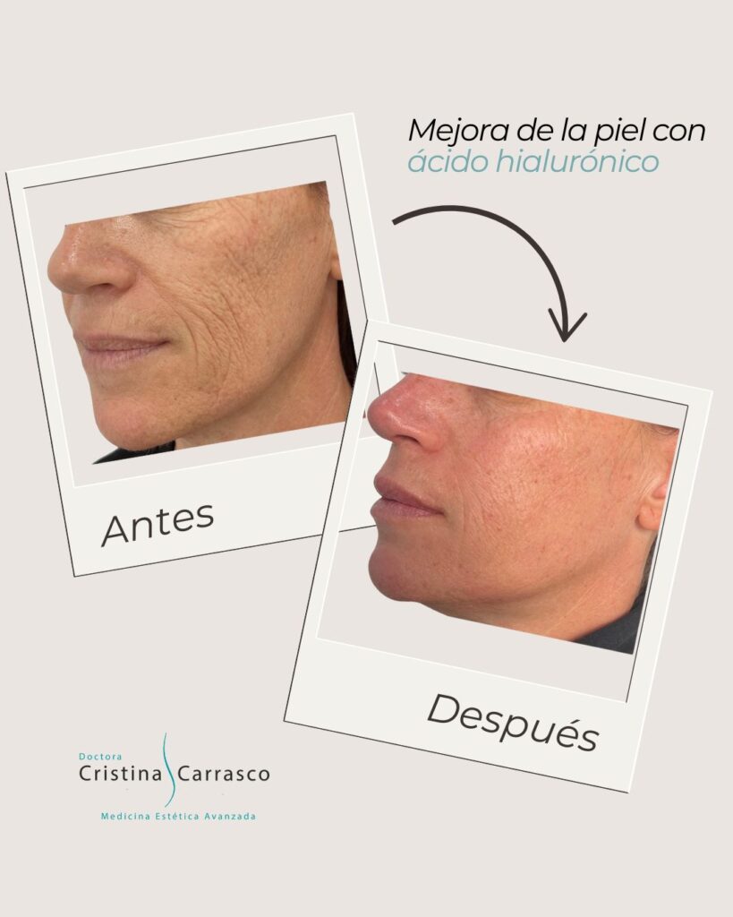Somos tu clínica estética de confianza en Sevilla. Conoce nuestros tratamientos estéticos para mujer y hombre sin cirugía. Estética facial y corporal.