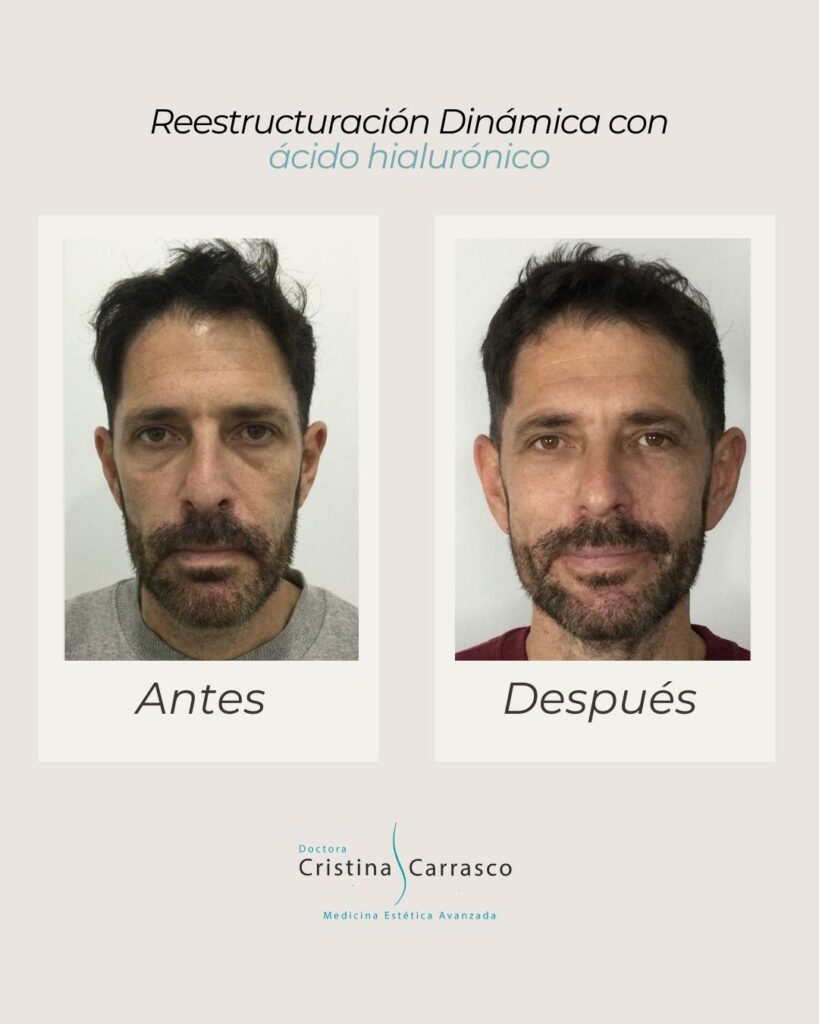 Somos tu clínica estética de confianza en Sevilla. Conoce nuestros tratamientos estéticos para mujer y hombre sin cirugía. Estética facial y corporal.