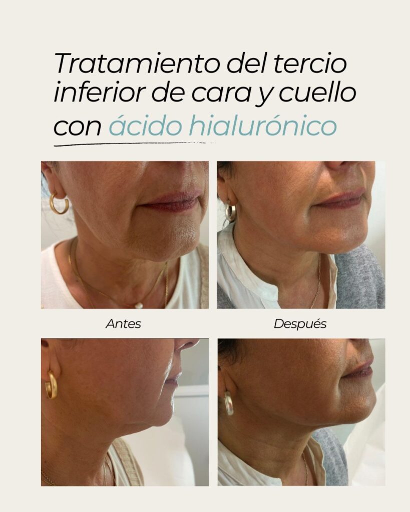 Somos tu clínica estética de confianza en Sevilla. Conoce nuestros tratamientos estéticos para mujer y hombre sin cirugía. Estética facial y corporal.